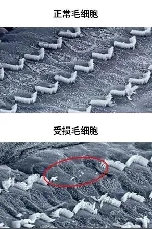 “耳机党”注意！这些习惯正在偷走你的听力……