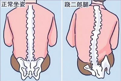 不良体态正悄悄损害你的健康
