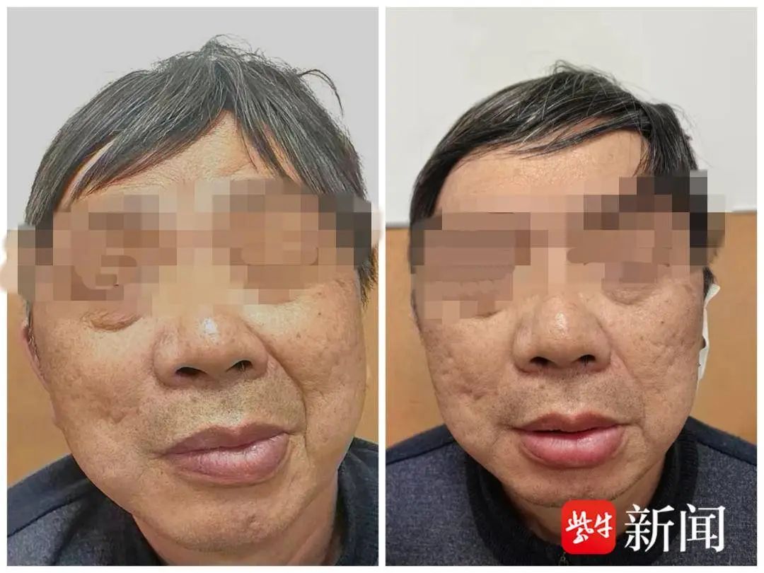 “挤眉弄眼”19年，六旬大叔深陷困境
