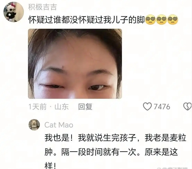34岁女演员称因爱闻自己宝宝的脚丫，导致眼睛感染肿胀！网友：突然知道原因了