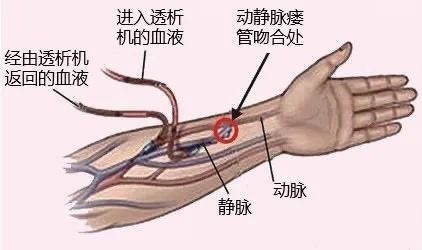 熬夜、外卖、快乐水，别等肾“报废”才后悔！这些信号别不当回事！