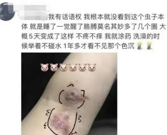 毒液堪比硫酸！这种虫子不要拍，近期多人受伤