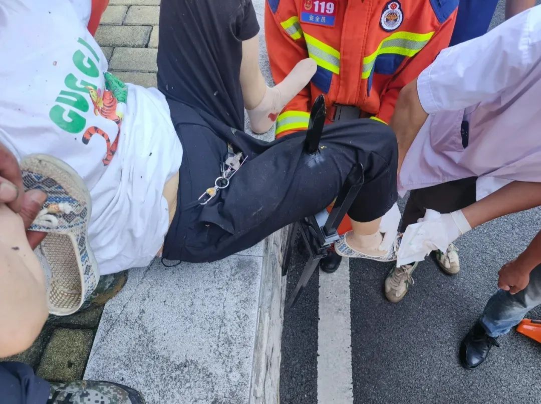 手、脸同时穿透！这条推送，请捂着眼睛看
