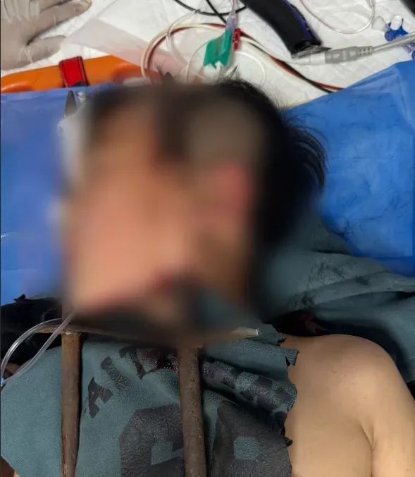 手、脸同时穿透！这条推送，请捂着眼睛看