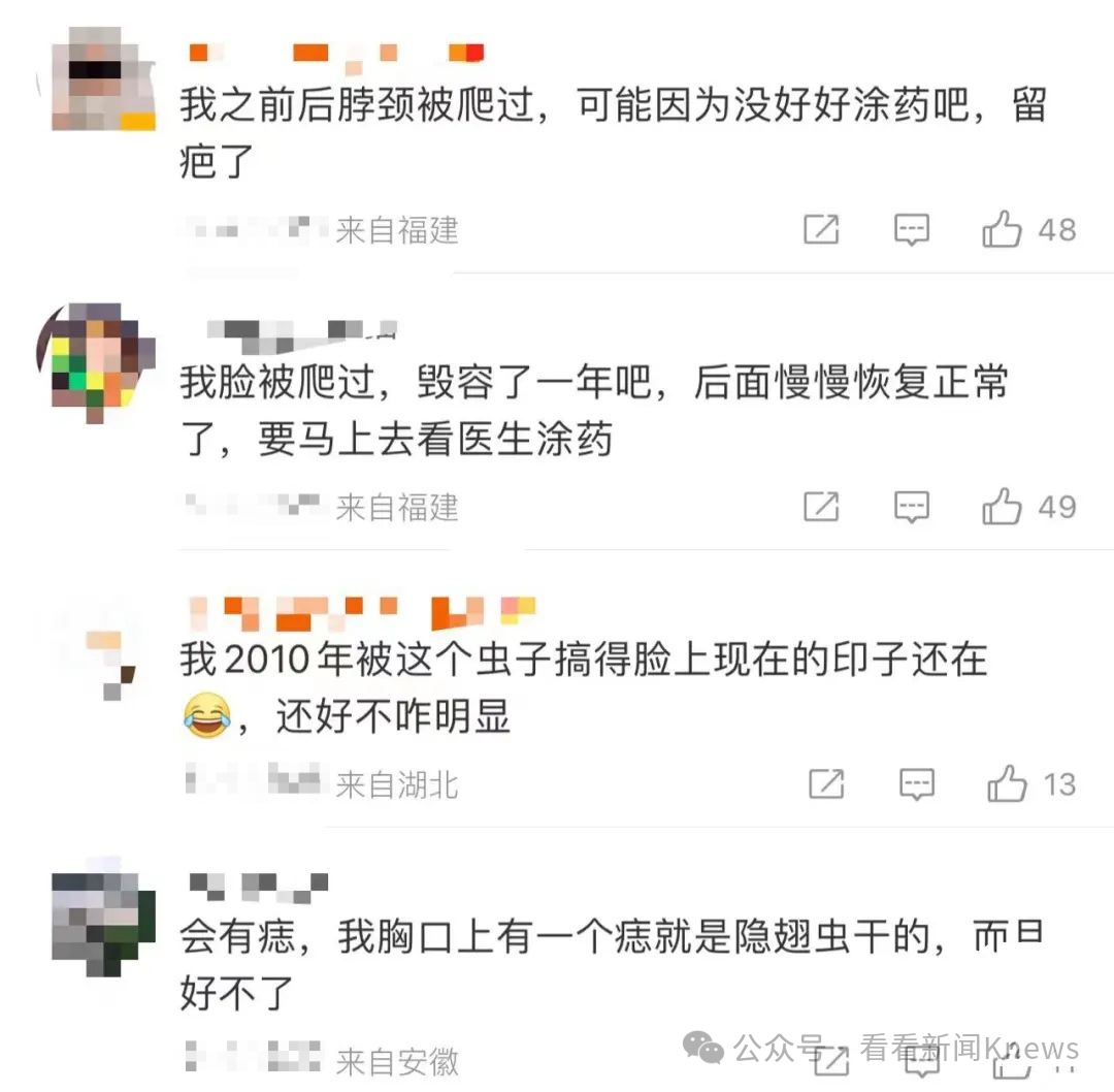 毒液堪比硫酸！ 一地医院已确诊200多例 上海已有人“中招”…医生这样提醒→
