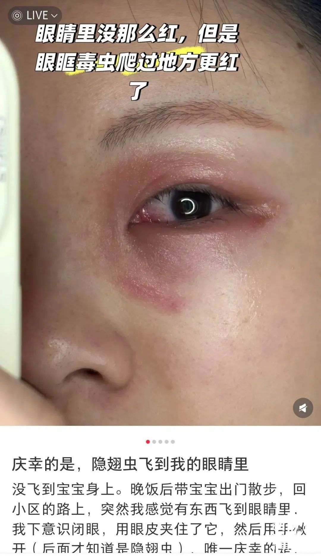 毒液堪比硫酸！一地确诊200多例，有人差点毁容，提醒：不要拍