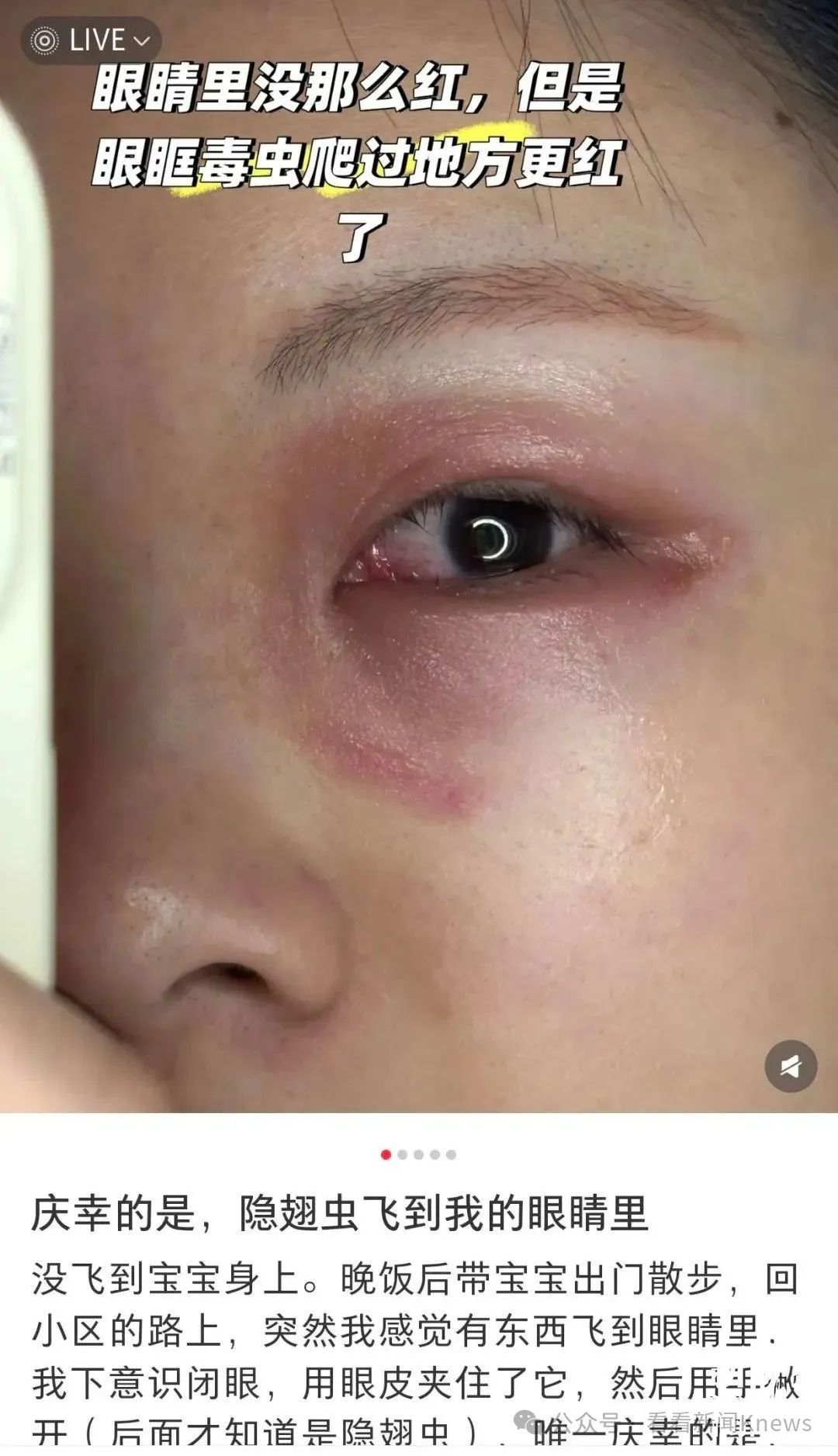 毒液堪比硫酸！ 一地医院已确诊200多例 上海已有人“中招”…医生这样提醒→