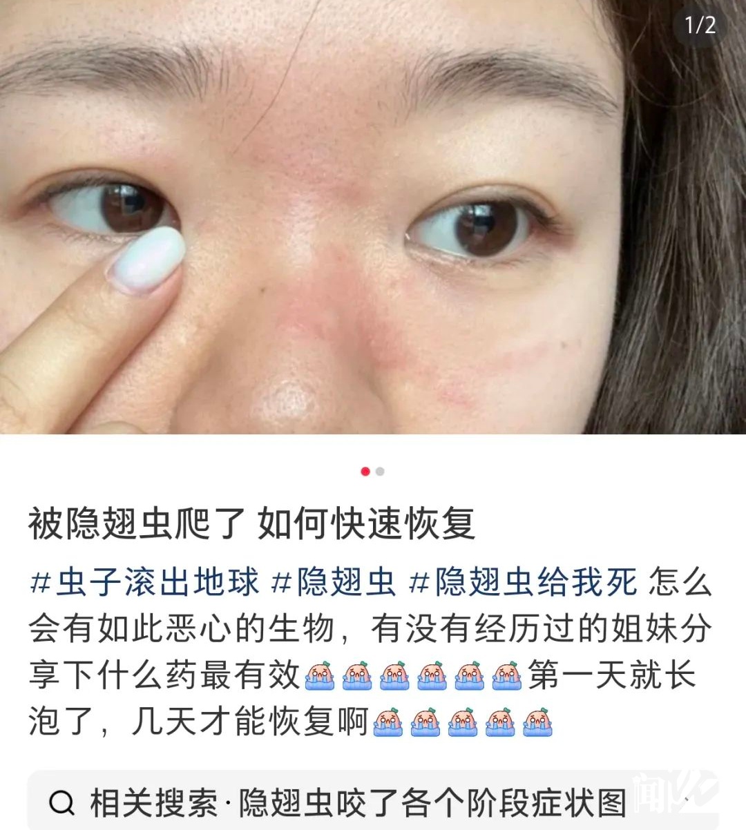 毒液堪比硫酸！一地确诊200多例，有人差点毁容，提醒：不要拍
