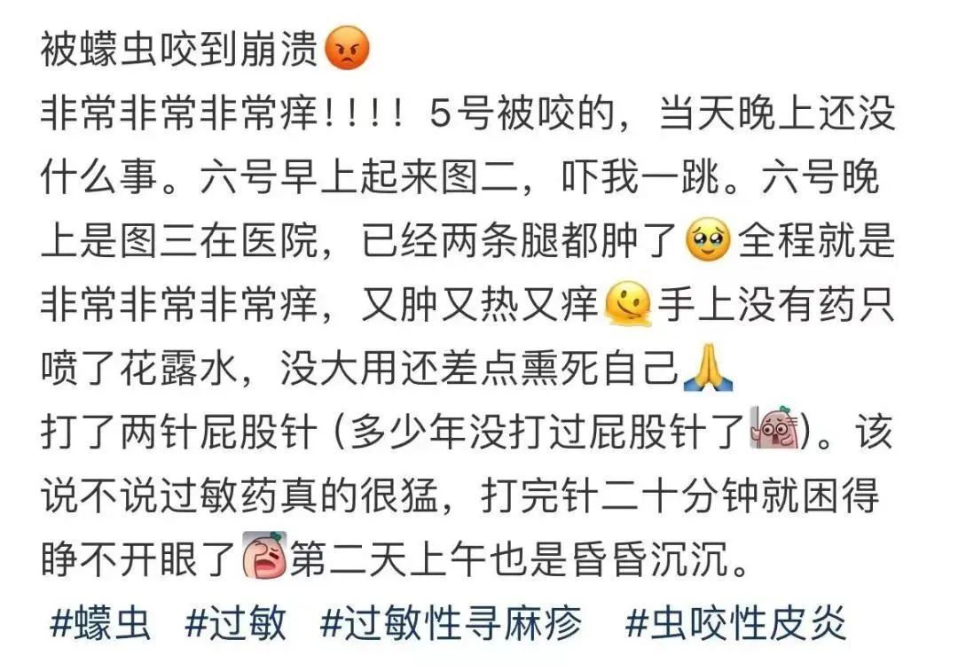 头皮发麻！感觉“全世界的虫都‘吻’了上来”