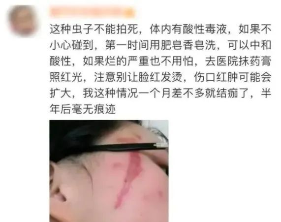 毒液堪比硫酸！这种虫子不要拍，近期多人受伤