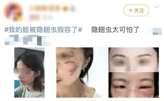 毒液堪比硫酸！这种虫子不要拍，近期多人受伤