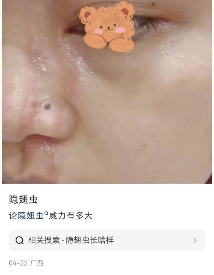 毒液堪比硫酸！最近多人“中招”，千万别拍打！