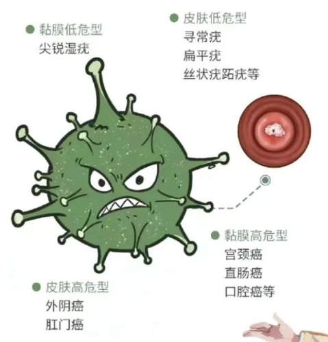 什么？！男生也会感染？也要接种HPV疫苗？