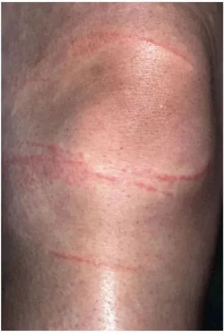 水母有毒！不要触碰！