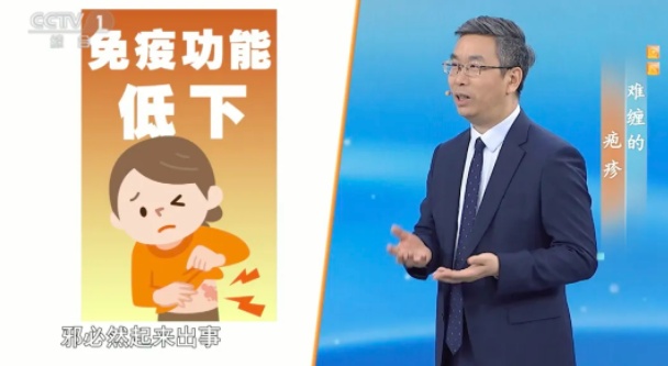 这种病毒50岁以上高发，这几个小贴士越早知道越好