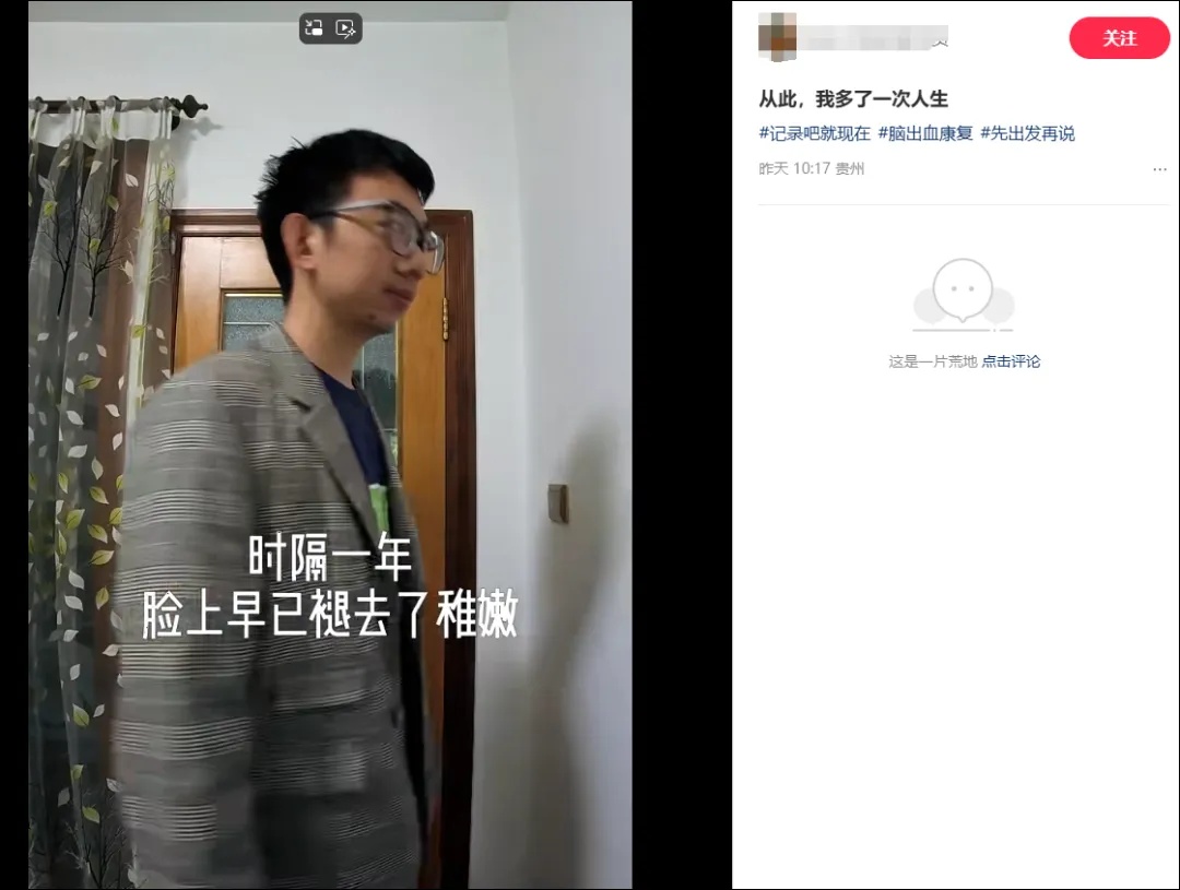 月薪3万，但未来可能要一辈子做康复！35岁脑出血程序员发长文：好好爱自己