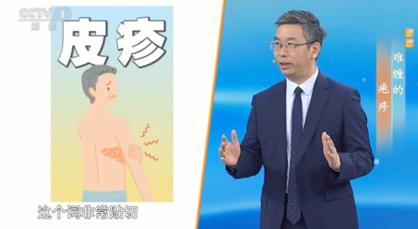 这种病毒50岁以上高发，这几个小贴士越早知道越好