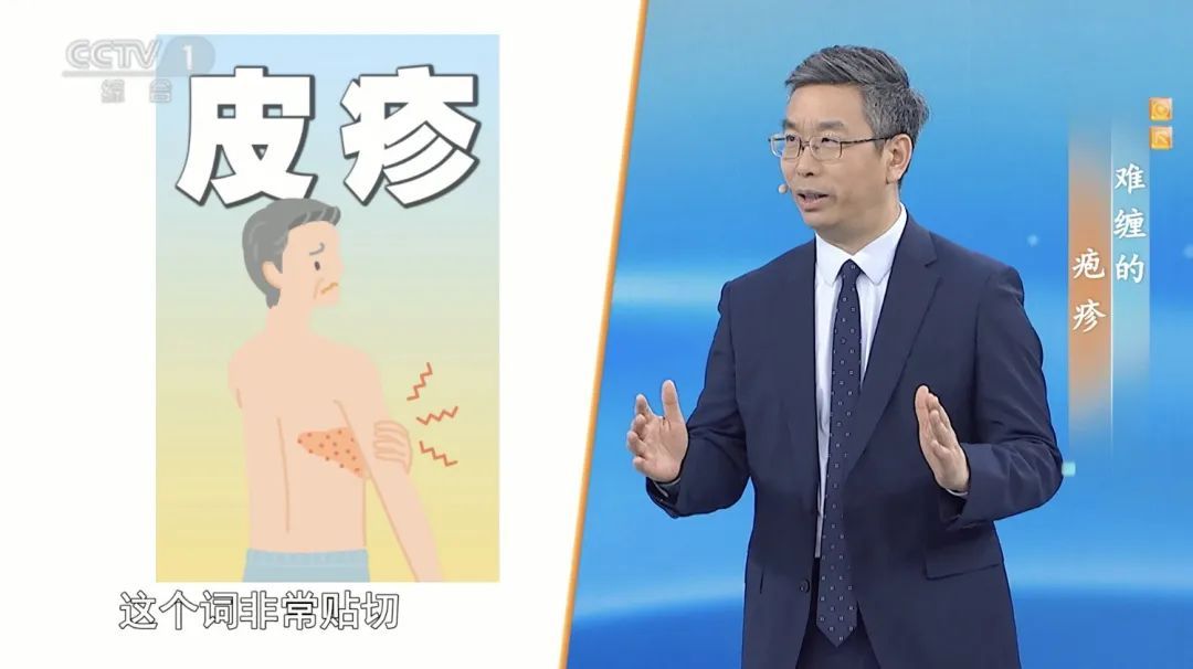 50岁以上高发！这种病毒90%的人群都可能会感染，令人痛不欲生，现在开始预防还不晚