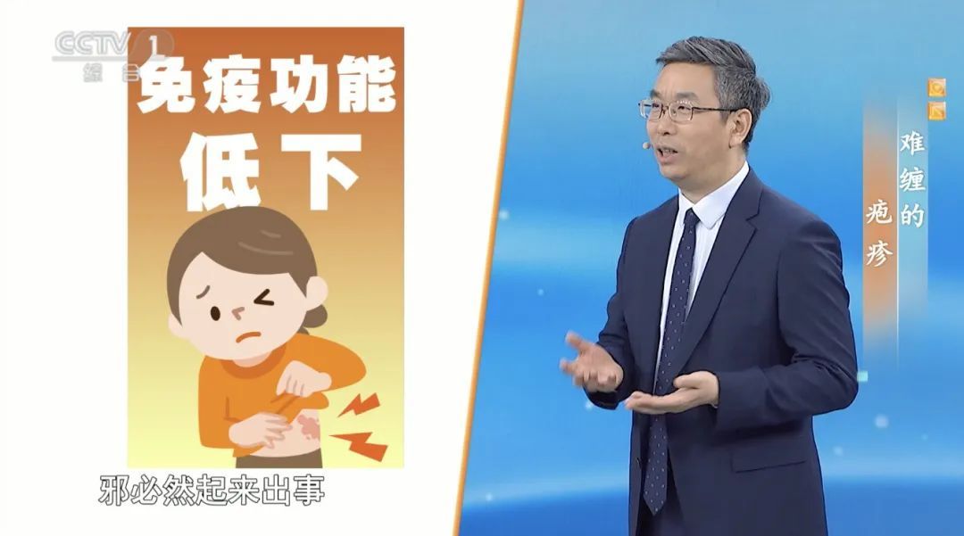 50岁以上高发！这种病毒90%的人群都可能会感染，令人痛不欲生，现在开始预防还不晚