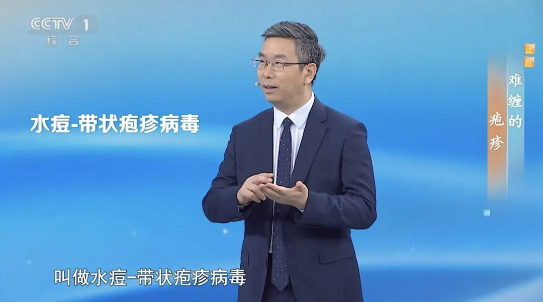 50岁以上高发！这种病毒90%的人群都可能会感染，令人痛不欲生，现在开始预防还不晚