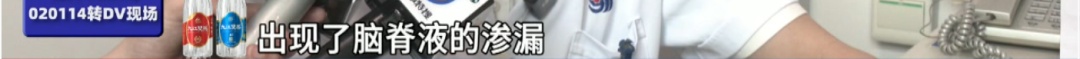 因为一次急刹车，32岁男子脑子漏水了？头痛到站立都困难