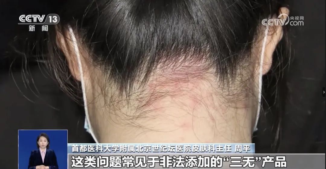 央视曝光！“爆款面膜”竟出自家庭作坊，霉菌重金属超标