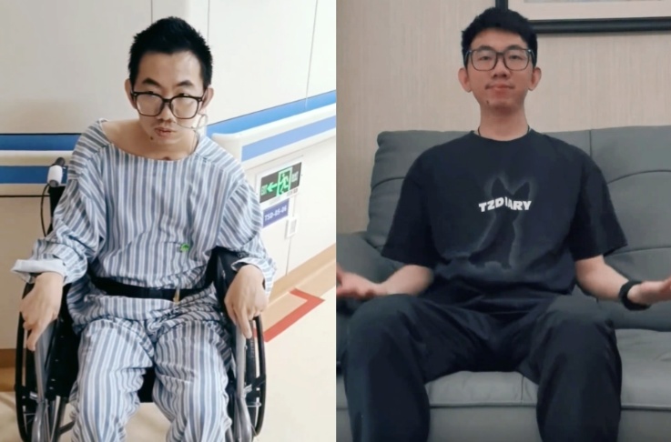 全网关注!35岁程序员长期熬夜脑干出血,紧急提醒→ 全网关注!35岁程序员长期熬夜脑干出血,紧急提醒→