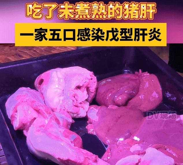 一家五口发病，只因一道家常菜！医生：春季高发，易聚集性感染