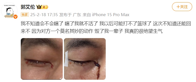 郭艾伦回应眼睛恢复情况，称“没啥事儿了”：只要不受伤，就能打好球