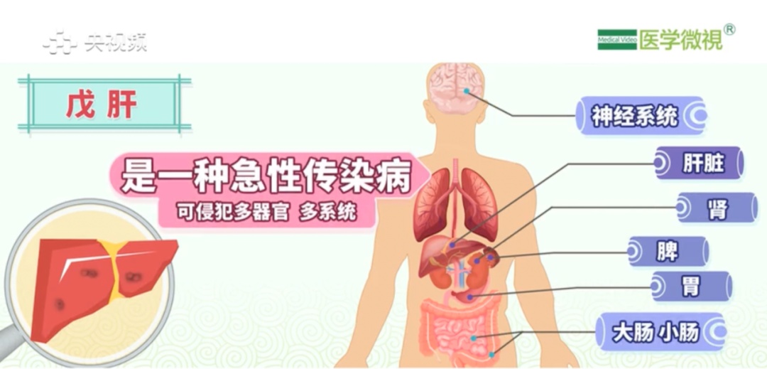 发热、恶心乏力…一家子接连感染，竟是因为一盘家常菜！