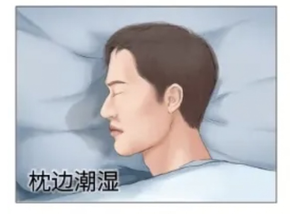 一个急刹车32岁男子脑子“漏水”了!太危险,这类人群当心→ 一个急刹车32岁男子脑子“漏水”了!太危险,这类人群当心→