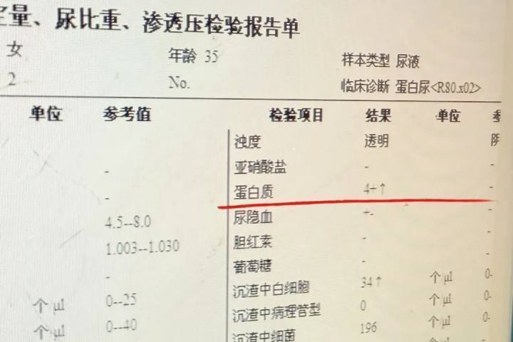 使用美容院推荐的美白祛斑霜，姐妹俩双双汞中毒进医院
