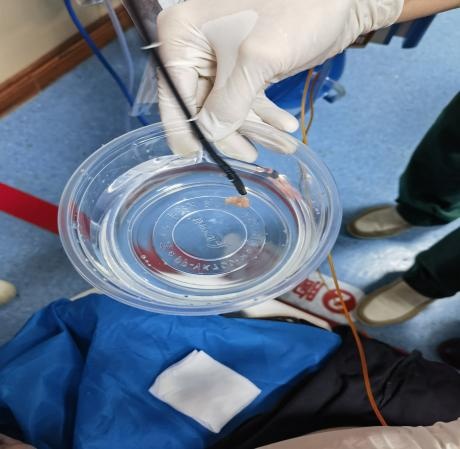 30岁男子被一粒肉末噎到昏迷20分钟，医生：学会这个很重要