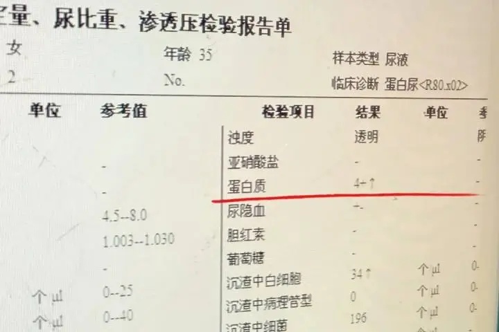 超标近50倍！姐妹俩双双中毒送医，只因用了同款面霜，严重或导致肾衰竭