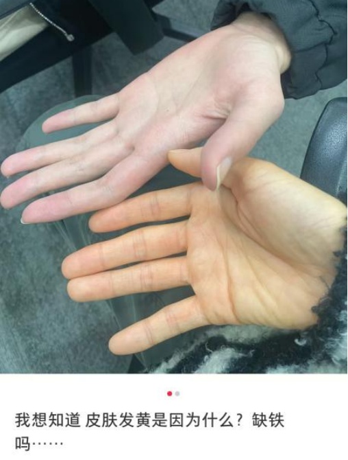 吃红枣、红糖、菠菜补铁?你真不如多吃两碗毛血旺! 吃红枣、红糖、菠菜补铁?你真不如多吃两碗毛血旺!