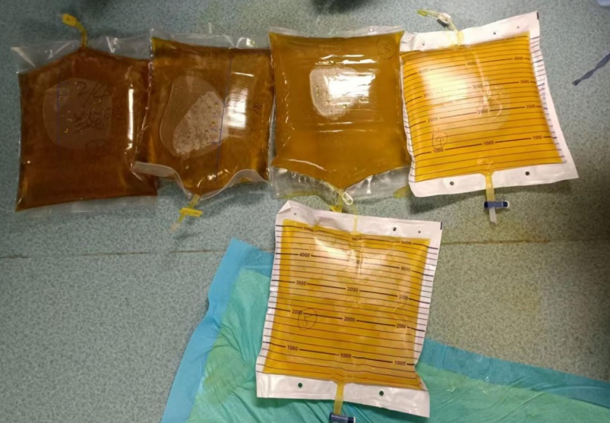 死亡率接近100%！一锅汤放倒一桌人 医生紧急提醒