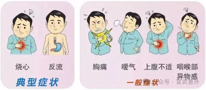 深夜的“酸爽”突袭——胃食管反流 深夜的“酸爽”突袭——胃食管反流