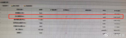 男子中年变丑竟因长了脑肿瘤
