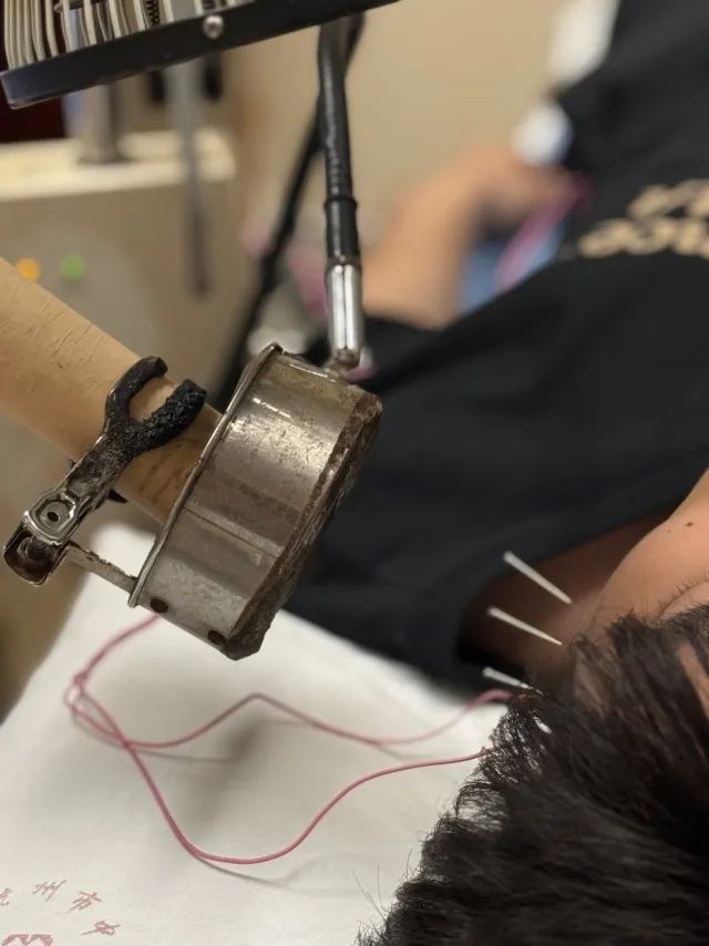 诊室里挤满人！这病专挑美女下手，多名女主播确诊！严重影响颜值→