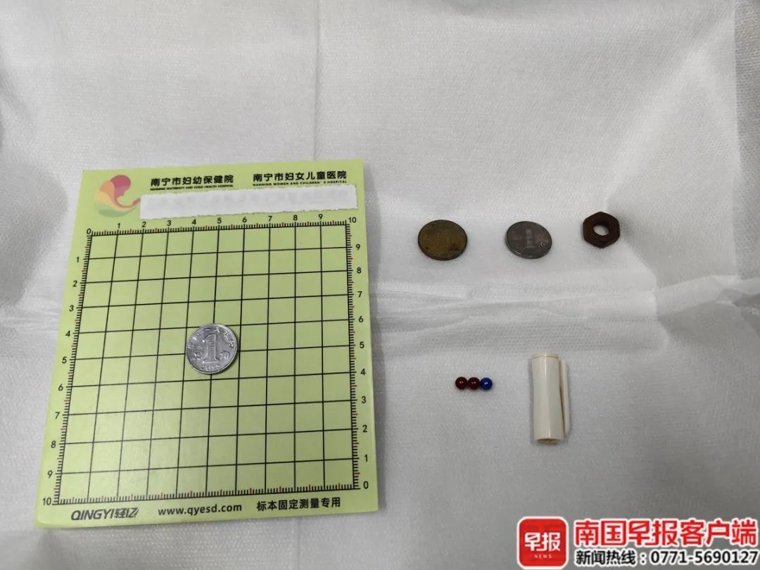 1岁多宝宝误吞硬币，家长急坏了！医生：这种情况要警惕