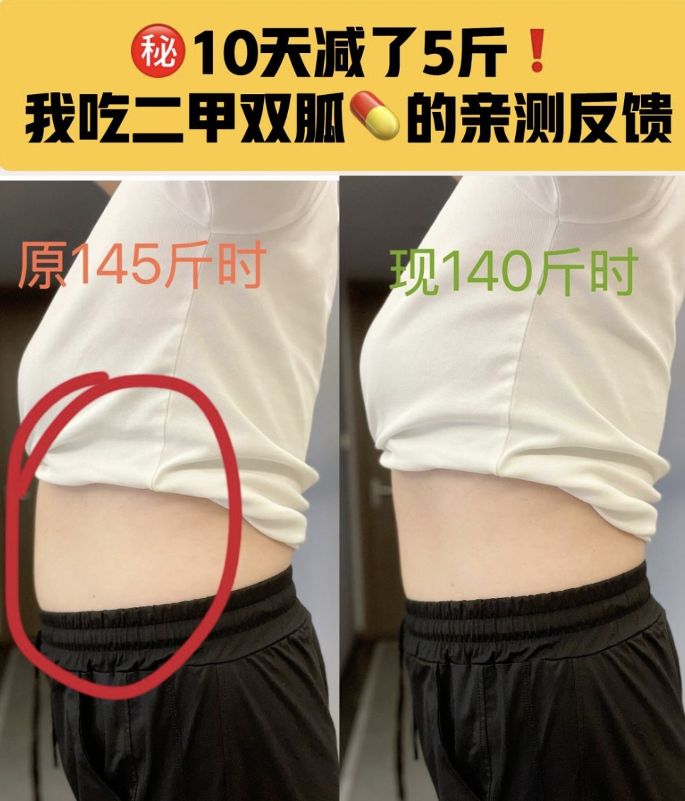 降糖、减肥、抗衰老“一把抓”？二甲双胍真的适合你吗？