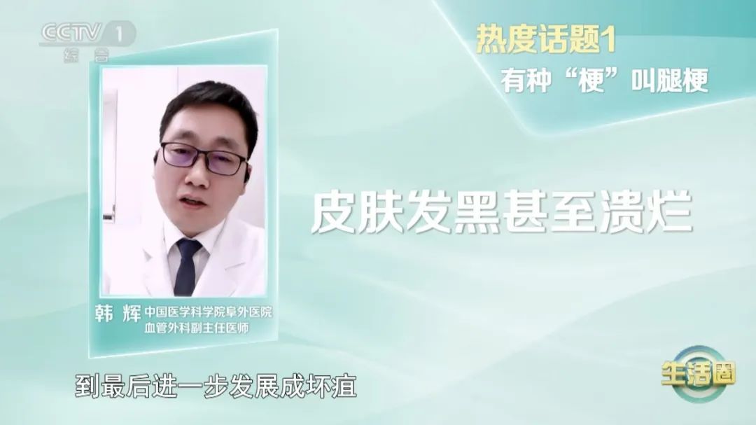 走路出现这些症状,可能是血管“堵”了!改掉6个不良习惯,打通血管的“高速通路”→ 走路出现这些症状,可能是血管“堵”了!改掉6个不良习惯,打通血管的“高速通路”→