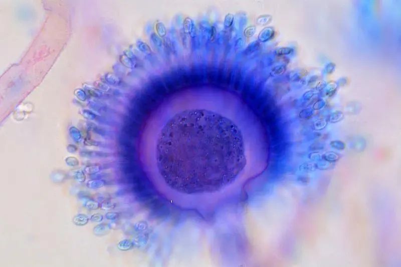 比砒霜毒68倍！女子整理衣柜后高烧40℃肺长菌斑，这个细节千万注意