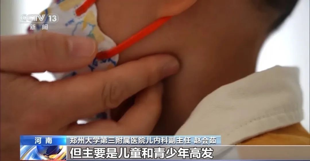 4岁孩子高烧不退，竟然患上“亲吻病”，出现这些症状速查→