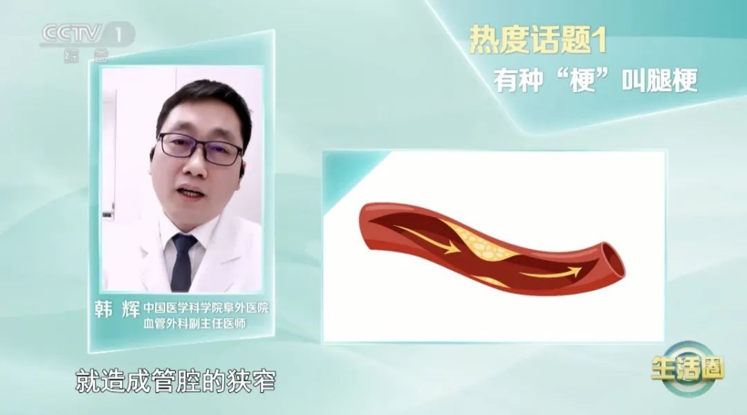 血管堵没堵，走两步！出现这4个信号就要当心，改掉6个坏习惯让你的血管强大起来