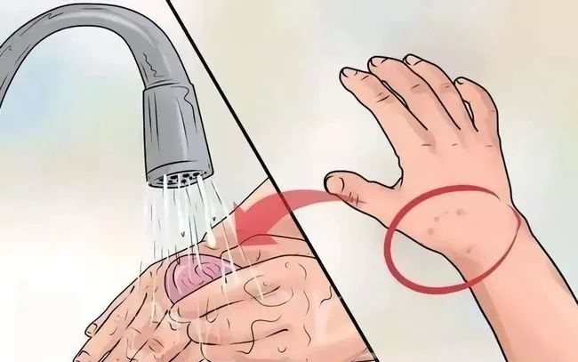 被咬一口肿到发胀！多地已出现，看到赶紧远离！