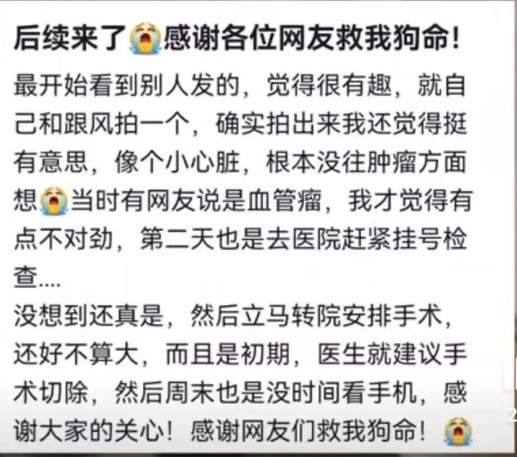 女生拿手电筒照手，网友发现不对劲！医生：这些危险信号要当心……