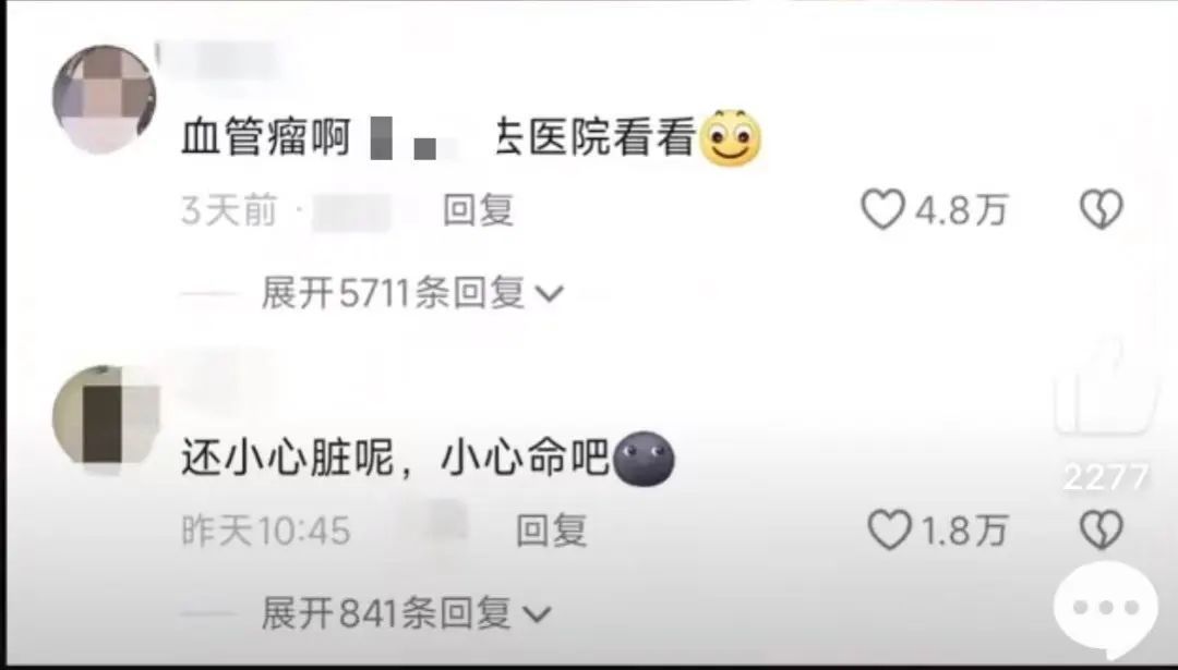 女生晒电筒照手图被网友发现不对劲!检查后确诊血管瘤立马住院手术,医生提醒 女生晒电筒照手图被网友发现不对劲!检查后确诊血管瘤立马住院手术,医生提醒