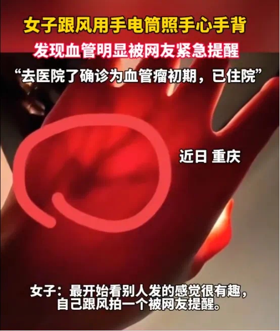 女生拿手电筒照手，网友发现不对劲！医生：这些危险信号要当心……