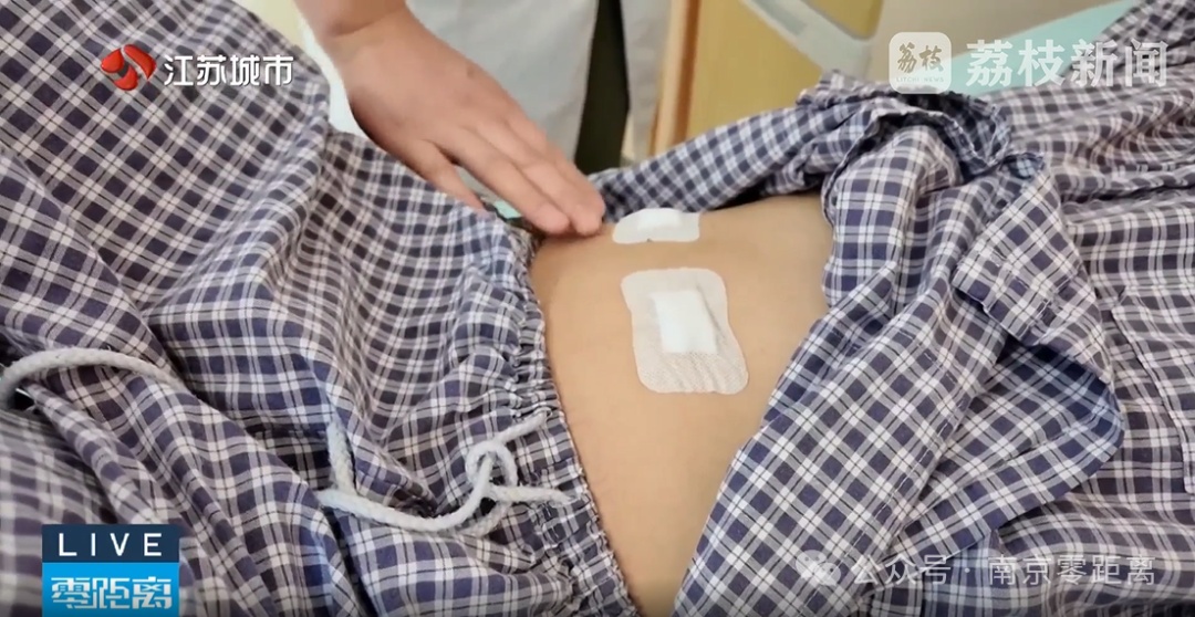 结肠出现巨大肿块,肠壁有虫卵!61岁男子头晕乏力误以为贫血发作! 结肠出现巨大肿块,肠壁有虫卵!61岁男子头晕乏力误以为贫血发作!